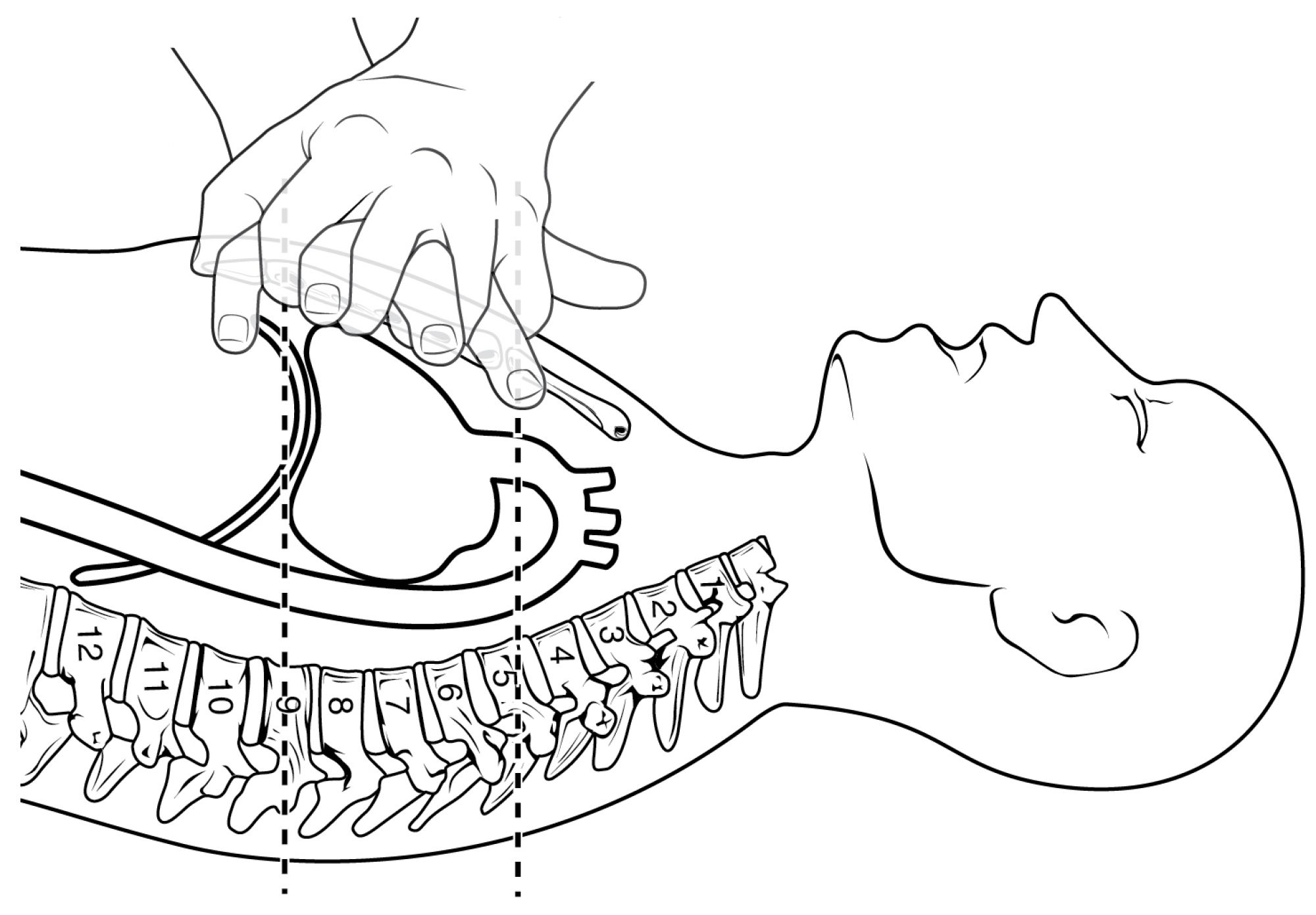 The Extreme Importance of Cardiopulmonary Resuscitation (CPR)